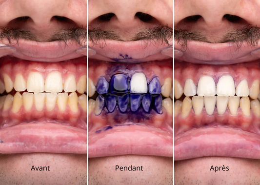 Dentifrice Violet Blanchisseur