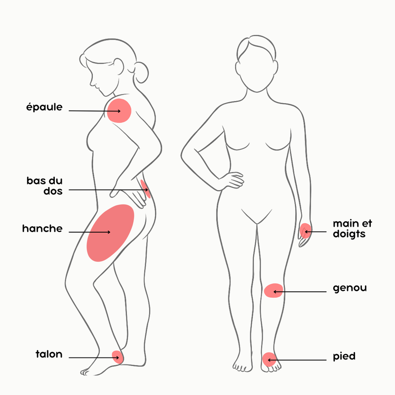 Body diagram